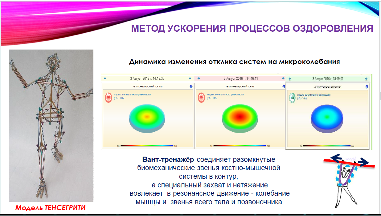 Динамика процесса. Остеокинезис. Резонансный остеокинезис. Вантовый остеокинезис. Остеокинезис таб.